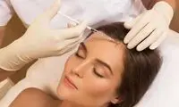 هزینه مزوتراپی مو در سال ۱۴۰۲ + جدول قیمت