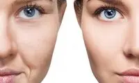 جوانساز هیبریدی نسل چهارم یا نخ مایع