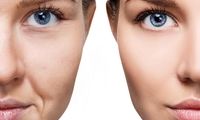جوانساز هیبریدی نسل چهارم یا نخ مایع