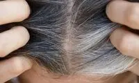 کشف راهی برای جلوگیری از سفید شدن موها