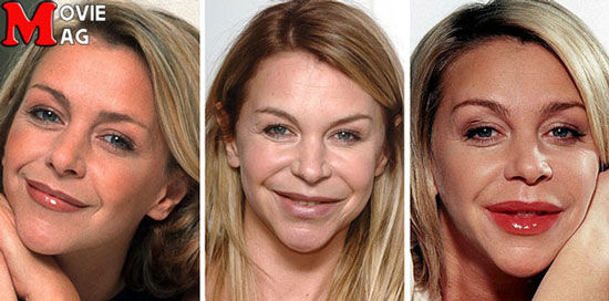 5 بازیگر که با جراحی پلاستیک چهره شان را از بین بردند!