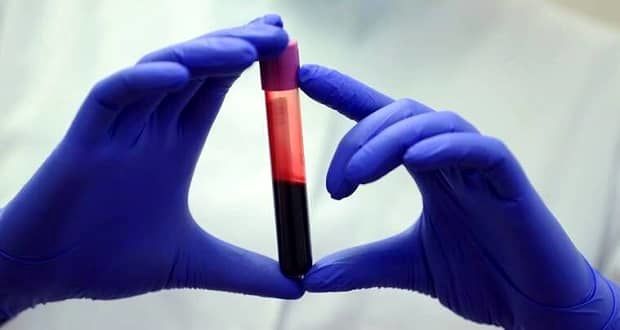 کشف یک گروه خونی جدید، دانشمندان را شوکه کرد
