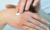 هفت راهکار خانگی برای خشکی پوست