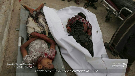 حمله خونین ائتلاف سعودی به بیمارستان یمن