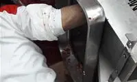 چرخ گوشت دست پسر 21 ساله را بلعید