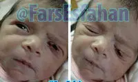 فاجعه پزشکی؛ این بار در نطنز! +عکس