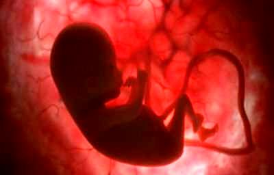روش جدید تشخیص تالاسمی از دوران جنینی