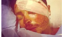 تصادف بسیار شدید مهدی امیر آبادی +عکس