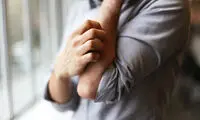 خارش پوست کلافه‌تان کرده؟