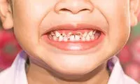 توجه به سلامت دهان و دندان‌ از کودکی
