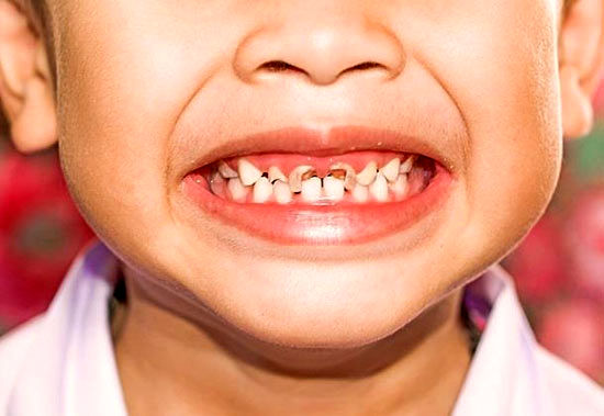 توجه به سلامت دهان و دندان‌ از کودکی
