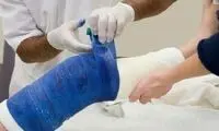 ۴۰ درصد افراد بالای ۴۰ سال پارگی تاندون دارند
