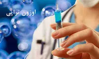 آرتروز داری؟ اُزن بزن!