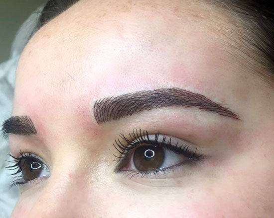 پاک کردن تاتو با چه روش‌هایی قابل انجام است؟