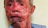 روستایی که اهالی آن ذوب می‌شوند (18+)