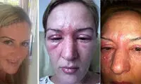 بهاي سنگين زيبایی براي این خانم +عکس