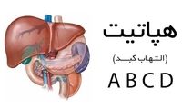 هپاتیت و راه‌های تشخیص آن