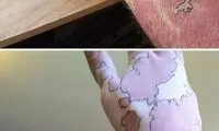 استفاده خلاقانه از ماه گرفتگی های مادرزادی روی بدن