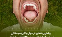 دانستنی‌های جالب؛ از دندان ویجی کومار تا پرنده مار گردنی!