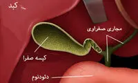 چرا صفرا راهش را گم می‌کند؟