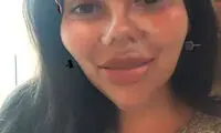 حذف تداعی‌کننده‌هایِ جراحی زیبایی در اینستاگرام