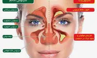 وقتی سینوس ها ملتهب می شوند