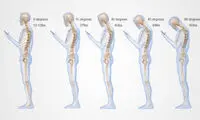 تاثیر استفاده از گوشی روی ستون فقرات