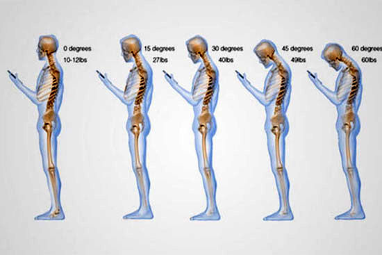 تاثیر استفاده از گوشی روی ستون فقرات