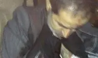 عکس: معاون وزیر پس از سوء قصد (18+)
