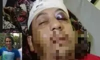 حمله به پناهجوی ایرانی در استرالیا
