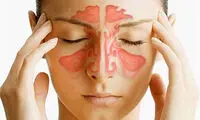 چگونه از شر سینوزیت خلاص شوید؟