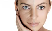 ترمیم طبیعی لکه های سیاهِ پوست