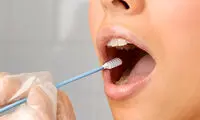 عواملی که موجب خشکی دهان می‌شوند