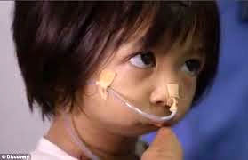 عکس: ساخت‎ دهان ‎برای‎ دختر بدون دهان!