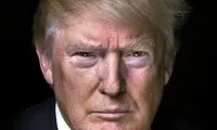 برنزه بودن صورت ترامپ به خاطر «ژن خوب» است