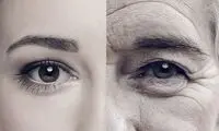 اگر این ۹ نشانه را دارید یعنی زودتر پیر می‌شوید