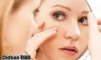 ۷ فایده معجزه‌آسای شیر برای سلامت پوست