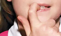 چرا فرزندم ناخن هایش را می جود؟