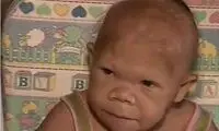 زن 35 ساله باچهره کودک 9 ماهه! + عکس