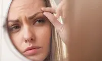 لیفت ابرو با نخ و تمام نکاتی که باید بدانید!
