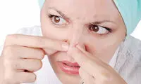 چند ماسک طبیعی، برای از بین بردن دانه‌های سر سیاه پوست