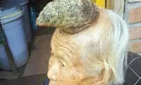 شاخ بزرگ روی سر زن چینی