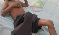 حمله دوباره تمساح به یک کودک