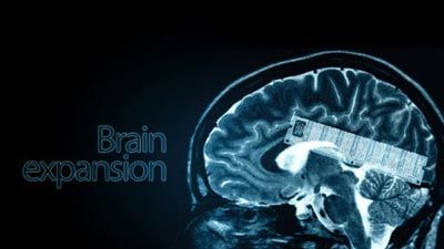 نخستین حافظه جانبی برای مغز ساخته شد