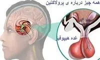 غده‌ای پُر رمز و راز در ساقه مغز انسان