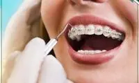 تفاوت انجام ارتودنسی در کودکان و بزرگسالان: ۵ تفاوت کلیدی و مهم