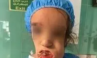شاهکار پزشکان ایرانی در جراحی دختر 11 ساله (16+)