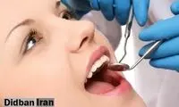کشف داروی رویش دندان توسط یک شرکت ژاپنی