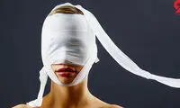 7 سلبریتی معروف که عمل زیبایی خاص انجام دادند 
