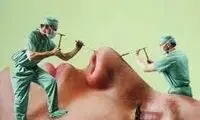 عکسی از اولین آگهی جراحی پلاستیک در سال 1333